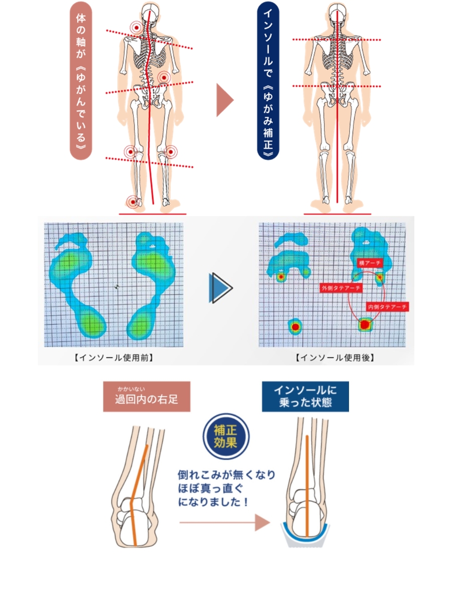 37PLUSインソール